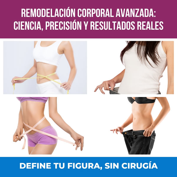 tratamiento corporal sin cirugía chiclayo